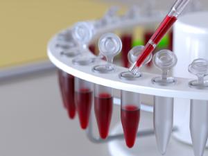 CFM orienta que mdicos peam exames de hepatites B e C, sfilis e HIV