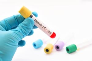 Paran registra cinco casos suspeitos de hepatite de origem desconhecida em crianas